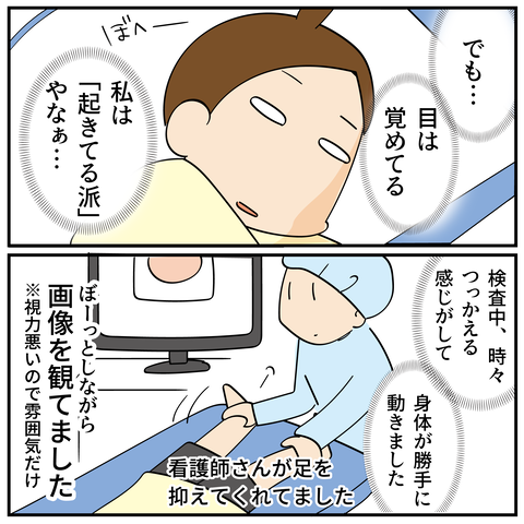 20240218大腸がん検査6_5