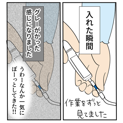 20240218大腸がん検査6_4