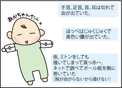 20151116アレルギー1