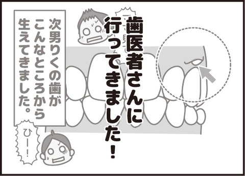 20180213抜いてきました1