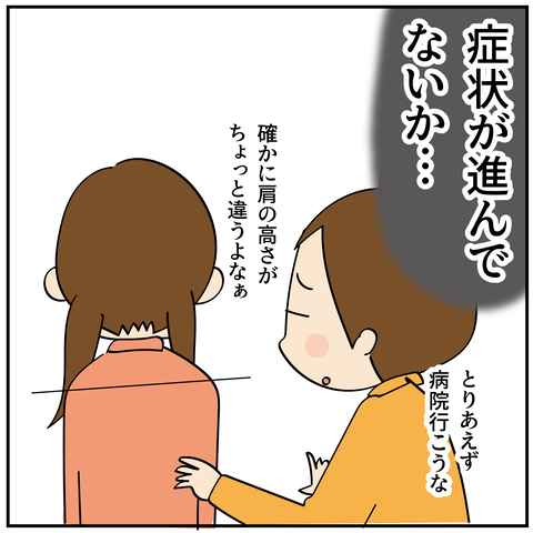 20240612側わん症_4