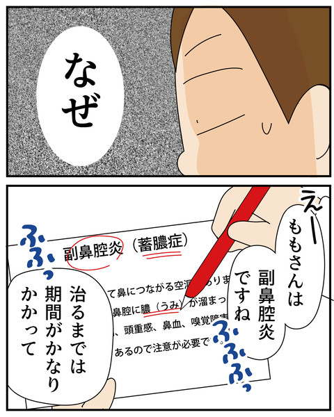 20270506副鼻腔炎_5