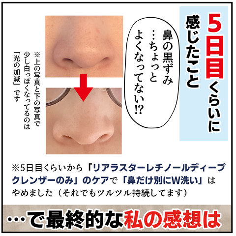 20240415レチノール_9