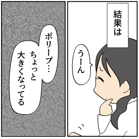 20240422子宮ポリープ1_5