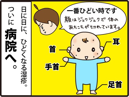 治らない乳児湿疹 ついに 病院に行きました ほわわん子育て絵日記 Powered By ライブドアブログ 治らない乳児湿疹 ついに 病院に行きました ほわわん子育て絵日記 Powered By ライブドアブログ