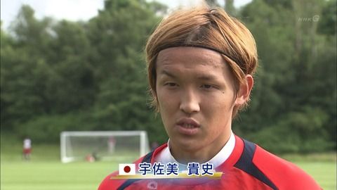 激論 宇佐美貴史ような金髪はハゲるのか 吹田のサポがまとめます 激論 宇佐美貴史ような金髪はハゲるのか 吹田のサポがまとめます
