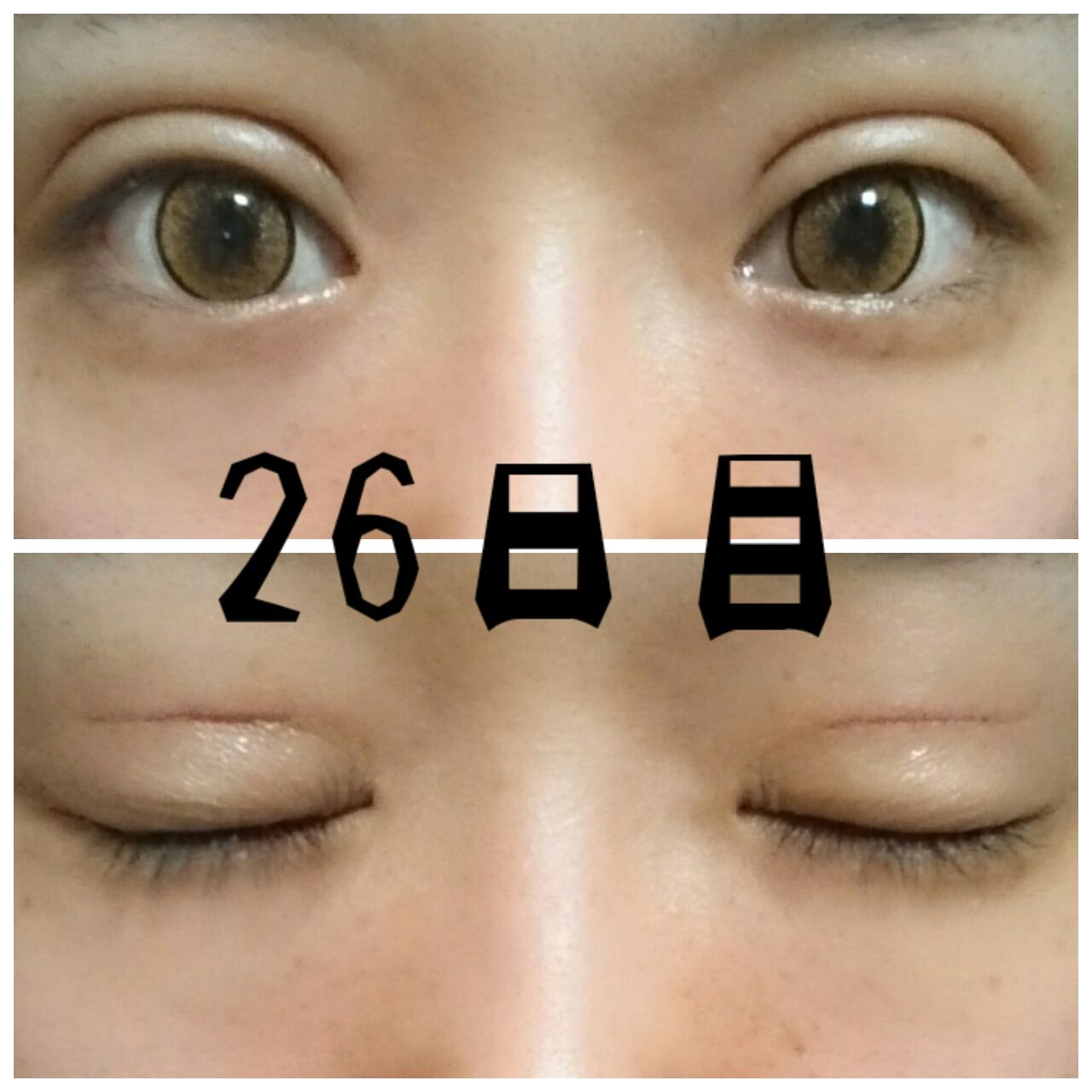 整形(目) ブスの悪あがきブログ