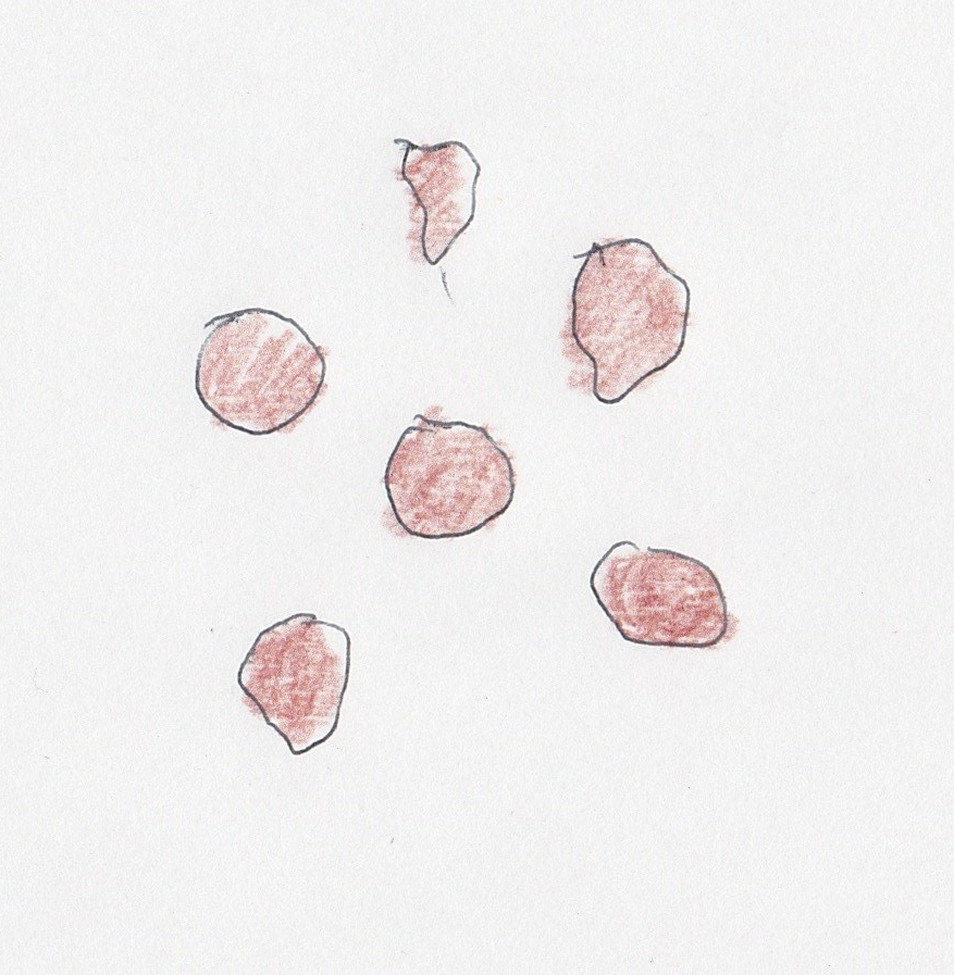 こんなうんちは便秘かも 幼児 便秘