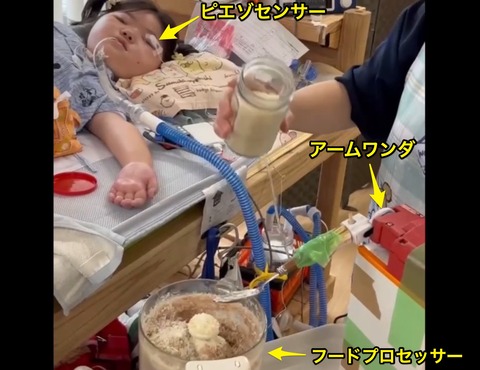 左まぶたに貼ったピエゾセンサーに入力してアームワンダを操作するNさん