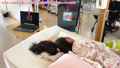 サムネイル枠を注視するBさん