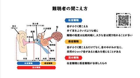 難聴者の聞こえ方