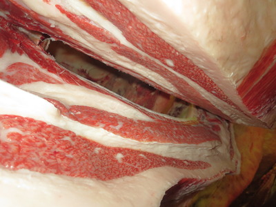 20201106.141�𸫭�