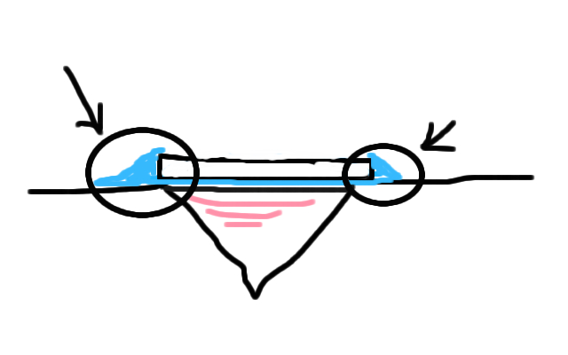 根気が大事 ウイルス性疣の治療法説明書