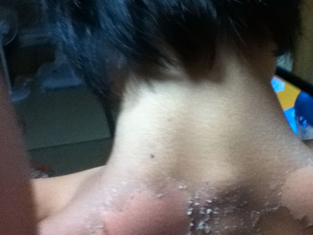 背中汚すぎワロタw やっほーげろげろ