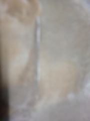__ (5)
