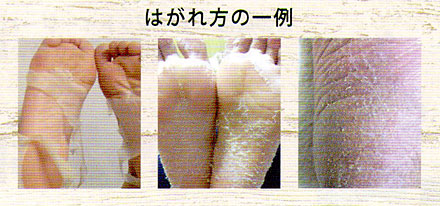 日記 ベビーフットを使ってみたのだが Hakka Nikki 日記 ベビーフットを使ってみたのだが Hakka Nikki