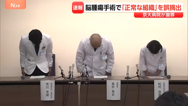 京大病院､脳腫瘍手術で｢正常な組織｣を誤って摘出する手術ミス 通常の生活送っていた患者が自発呼吸不能の重篤状態に