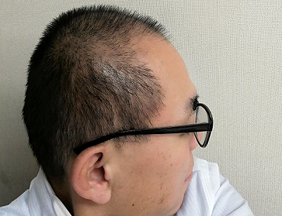 スキンヘッドを1カ月伸ばしてみたら 英語教室 以学館 教室便り スキンヘッドを1カ月伸ばしてみたら 英語教室 以学館 教室便り