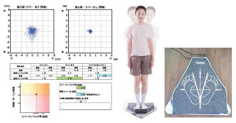 五十嵐内科 仙台市宮城野区福室 内科 呼吸器内科 循環器内科 生活習慣病 おすすめ 健康寿命をのばしましょう。 カラダも，ココロも，社会的​にも健康に。 院長 生活習慣病 高血圧症 糖尿病 脂質異常症 高尿酸血症 痛風 かぜ インフルエンザワクチン 気管支喘息 咳喘息 アレルギー性鼻炎 花粉症 片頭痛 脱水症 熱中症 便秘症 急性胃腸炎 感染性腸炎 機能性胃腸症 過敏性腸症候群 じんましん 帯状疱疹 口内炎 口唇ヘルペス 漢方治療 不眠症 鉄欠乏性貧血 亜鉛欠乏症 膀胱炎 更年期障害 自律神経失調症 めまい 予防接種 各種ワクチン 健康診断 企業健診 仙台市特定健診 仙台市基礎健診 各種診断書 にんにく注射 プラセンタ注射 プラセンタサプリメント AGA治療 男性型脱毛症治療 ED治療 勃起不全治療 舌下免疫療法 シダキュア 産業医 禁煙外来 6種類の手作り血圧手帳 無料ダウンロード 宮城県 診療・検査医療機関 発熱外来 新型コロナウイルス COVID-19 PCR検査 抗原検査 中和抗体検査 オンライン診療 クレジットカード決済 睡眠時無呼吸症候群治療 おすすめ 簡易検査 酸素飽和度 精密検査 PSG検査 終夜睡眠ポリグラフ検査 CPAP治療 持続陽圧呼吸療法 いびき治療 おすすめ