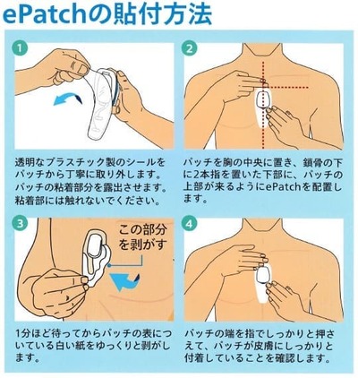 ホルター心電図 フィリップス（PHILIPS）002