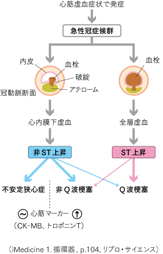 pk1急性冠症候群-のコピー