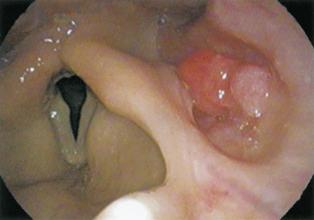 107D26