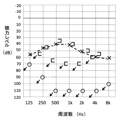 107A56