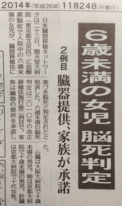 脳死