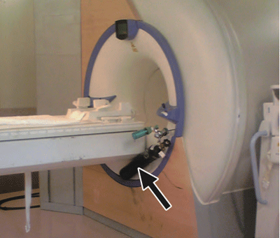 mri2