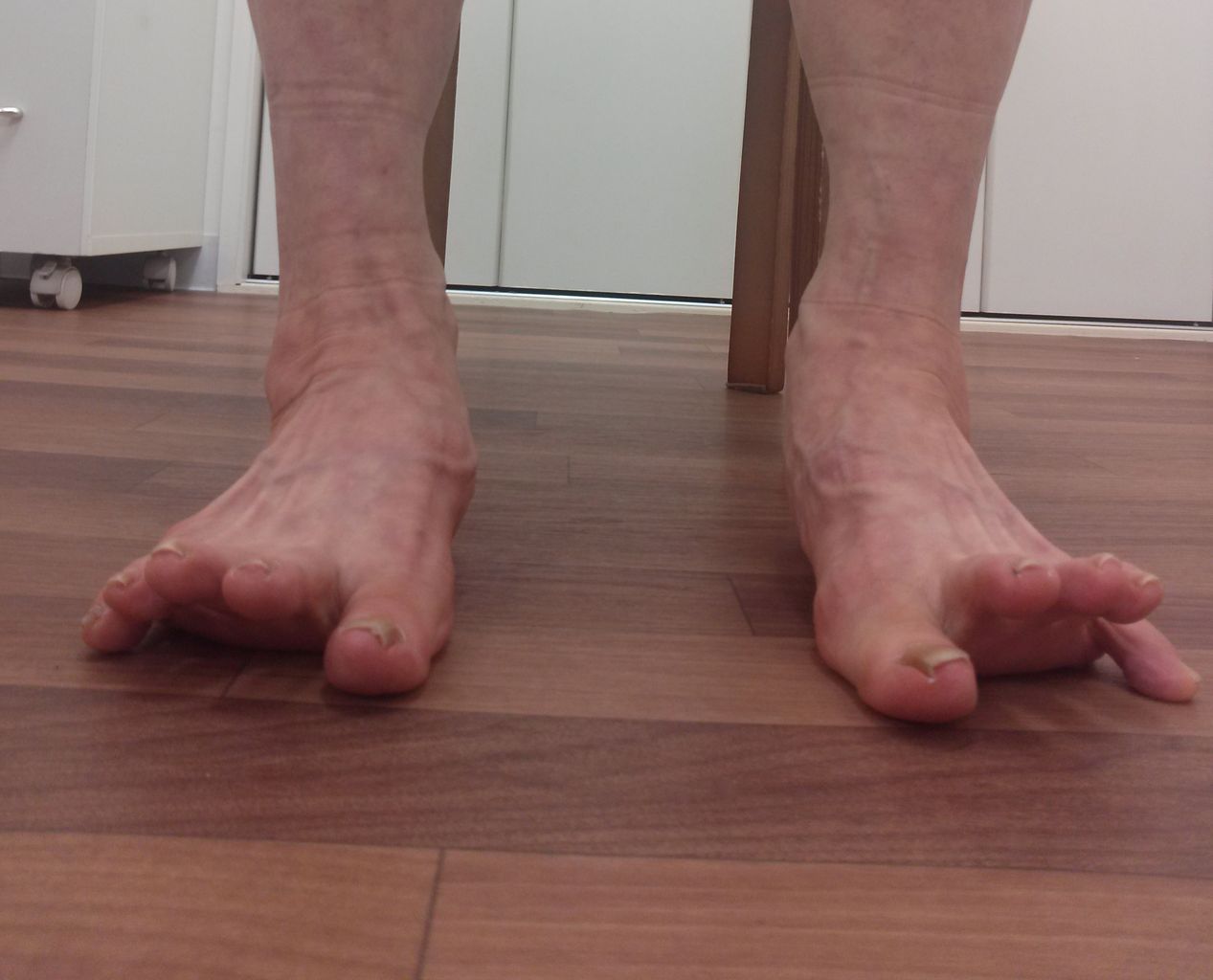 足のトレーニング 7 足裏 親指と小指のコントロール 追記あり いけちゃんのblog 練馬区関町の池島接骨院 院長日記 バレエ テーピング 足底板など 足のトレーニング 7 足裏 親指と小指のコントロール 追記あり いけちゃんのblog 練馬区関町の池島接骨院 院長日記 バレエ テーピング 足底板など