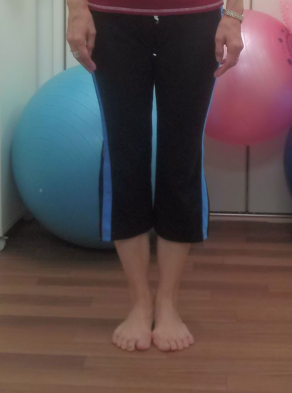 色々な足 57 テーピング勉強会のモデルをしてくれた50代のバレエ愛好者 足関節捻挫 腰痛 側弯症 脛骨外捻 いけちゃんのblog 練馬区関町の池島接骨院 院長日記 バレエ テーピング 足底板など