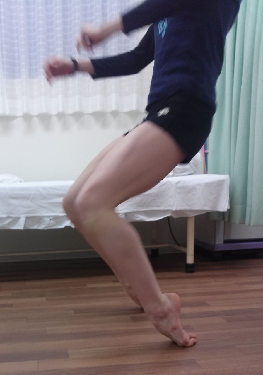 色々な足 9 新体操 いけちゃんのblog 練馬区関町の池島接骨院 院長日記 バレエ テーピング 足底板など