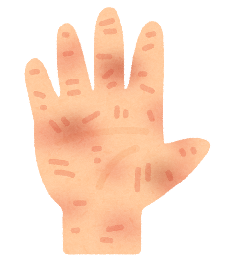body_hand_areru.png