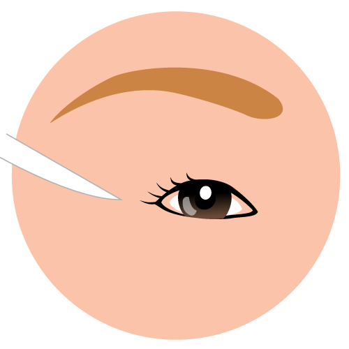 目尻切開のイラスト 美容整形 エステのイラスト素材集 目尻切開のイラスト 美容整形 エステのイラスト素材集