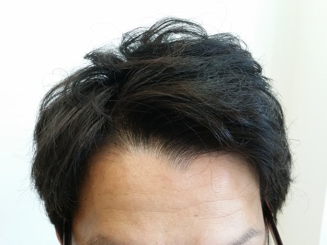 エンジェリックケアの効果にびっくりした 東武練馬美容室イロのブログ 髪質改善縮毛矯正が人気の美容院