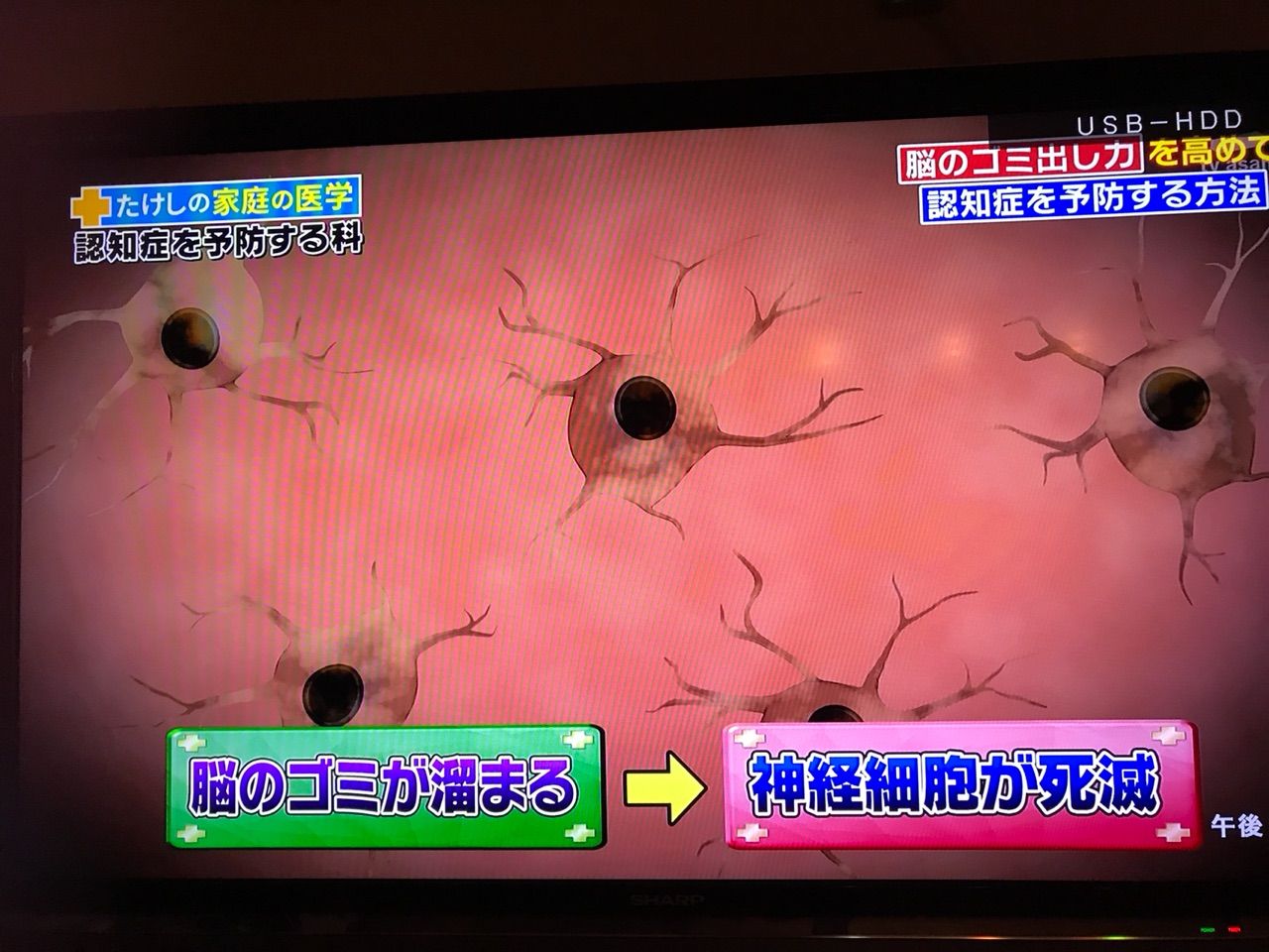 20170712 Tvたけしの家庭の医学 脳のごみを捨てて認知症を防ぐ ぽこしゃん日記