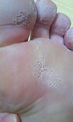 閲覧注意 足がメッシュ状になったグロ画像wwwwwww ブキミーベイベー