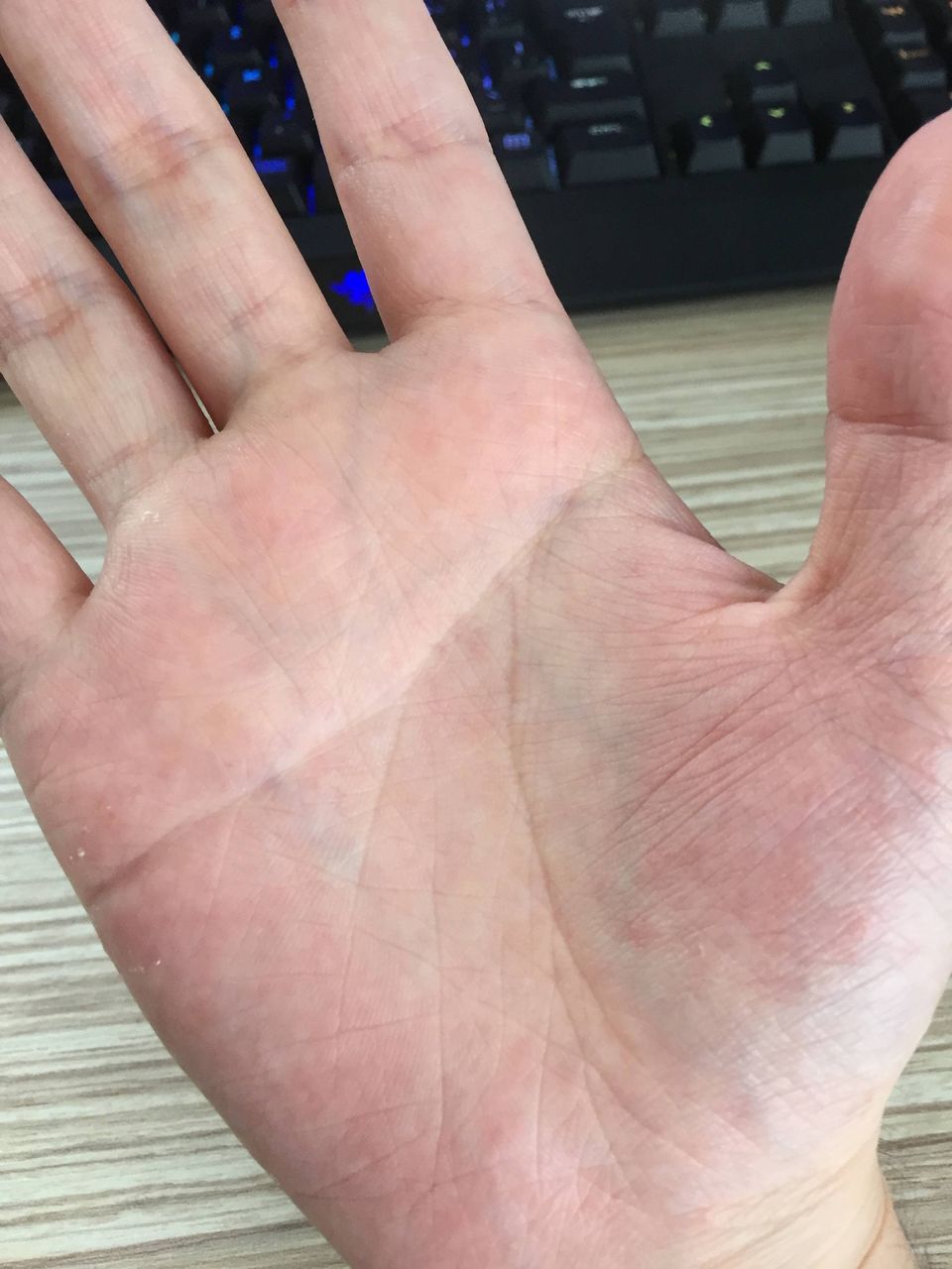 画像 お前ら手相でこの珍しい手相知ってる 知恵速