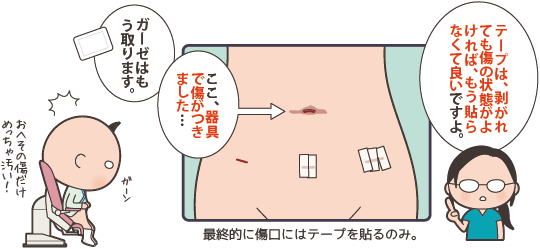 腹腔鏡手術の創部