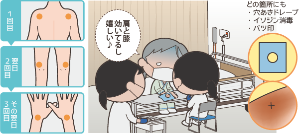 ステロイド注射
