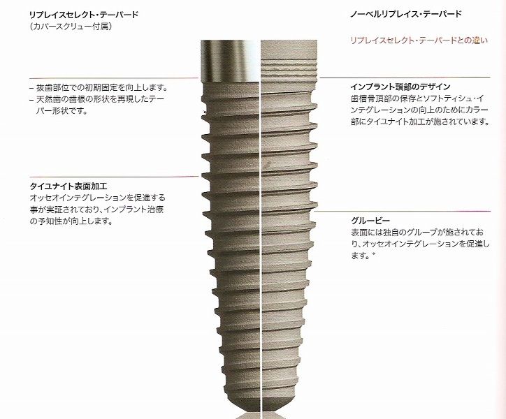 ノーベルバイオケア インプラント総合カタログ 岩手 盛岡 松舘歯科 岩手盛岡の松舘歯科インプラントセンター