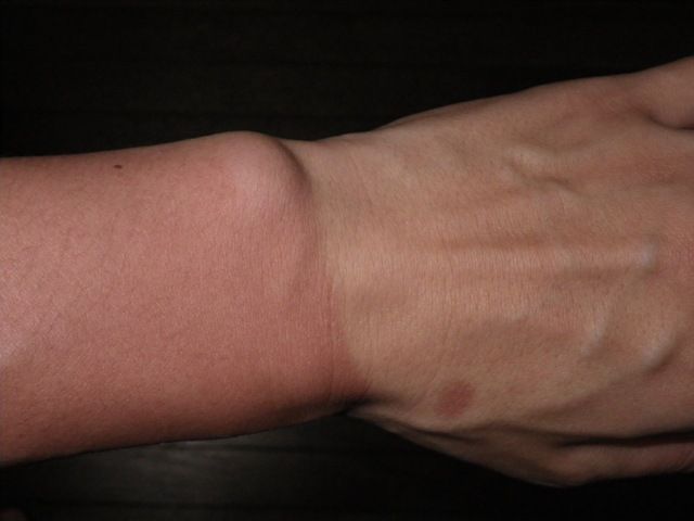 変な日焼け跡を消しました 毎日がヒルクライムに挑戦してみるよ