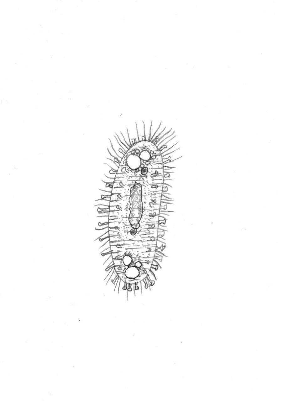 吸管虫類 Suctoria の幼生 もしくは他の繊毛虫 動画つき 滴虫界 Infusorian World Ciliates Amoebae Flagellates ｅｔｃ