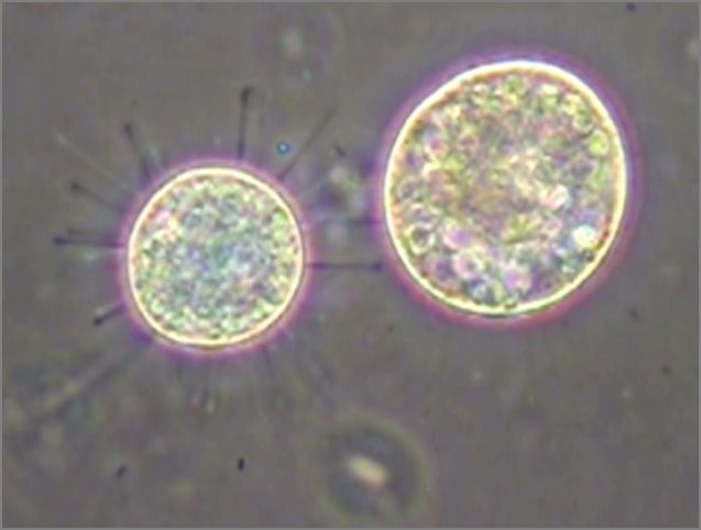 滴虫界 (Infusorian World）Ciliates，Amoebae，Flagellates，etc ...