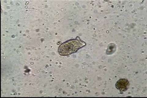 滴虫界 (Infusorian World）Ciliates，Amoebae，Flagellates，etc... : Spathidium ...