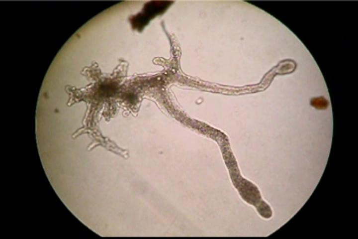 滴虫界 (Infusorian World）Ciliates，Amoebae，Flagellates，etc... : Amoebidaアメーバ目