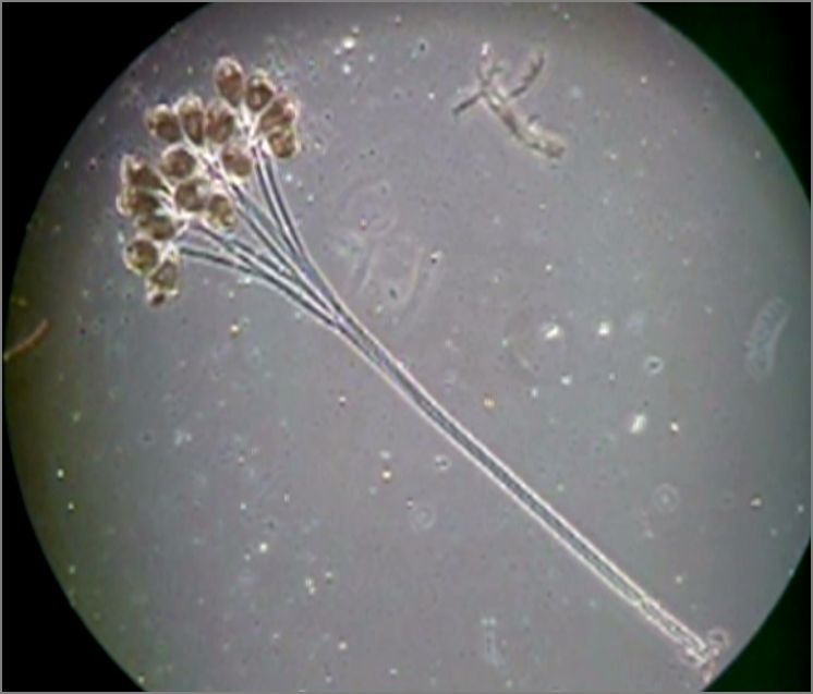 滴虫界 (Infusorian World）Ciliates，Amoebae，Flagellates，etc... : Epistylis ...