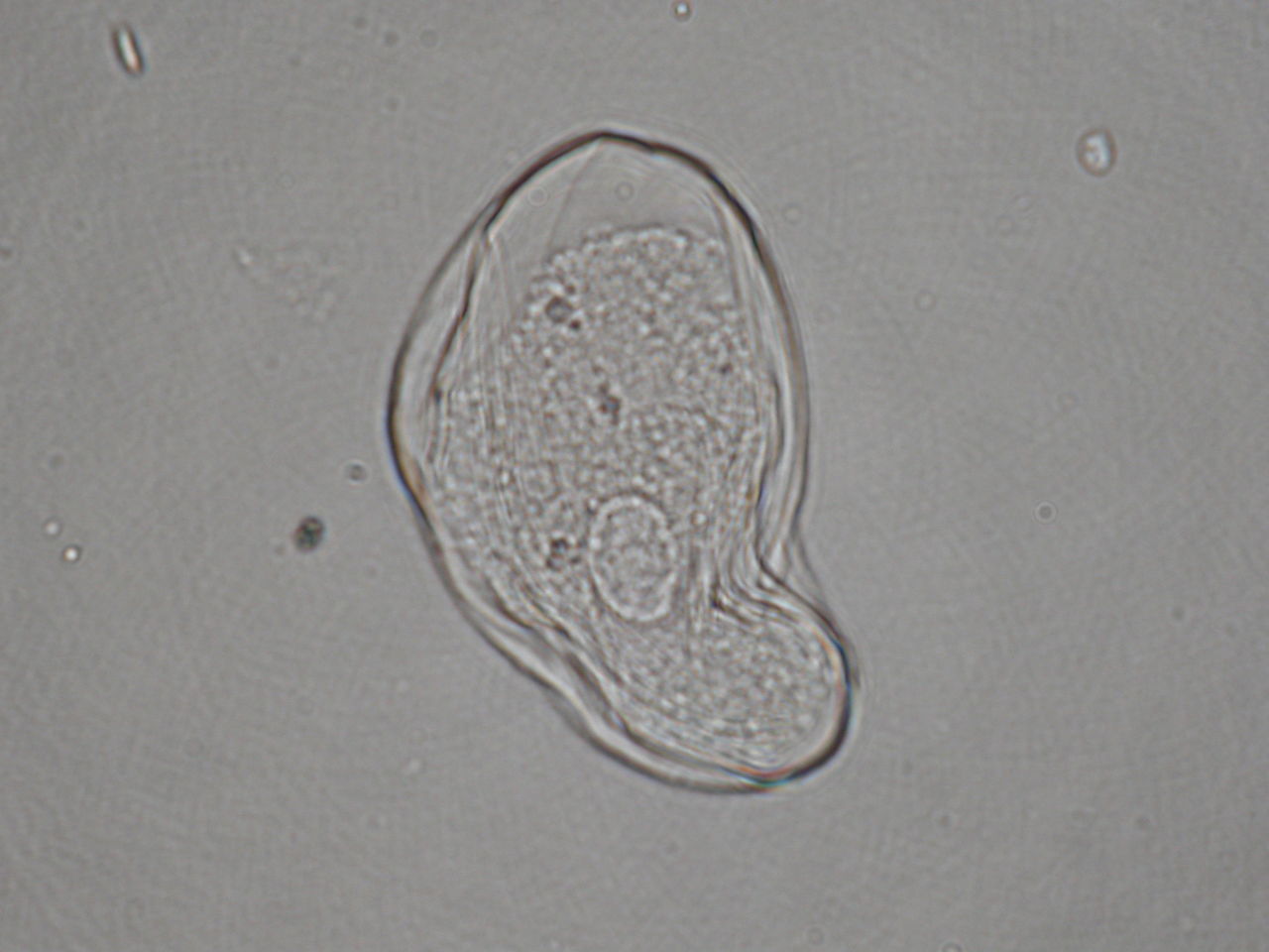 Thecamoeba Striata すじおいアメーバ テーカアメーバ類 滴虫界 Infusorian World Ciliates Amoebae Flagellates ｅｔｃ