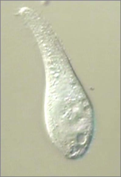 滴虫界 (Infusorian World）Ciliates，Amoebae，Flagellates，etc... : Lionotus ...