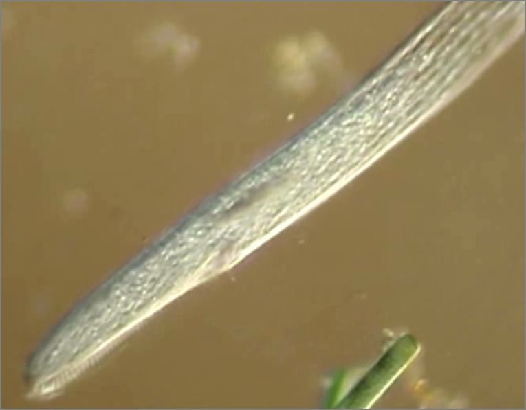 滴虫界 (Infusorian World）Ciliates，Amoebae，Flagellates，etc... : Spirostomum ...